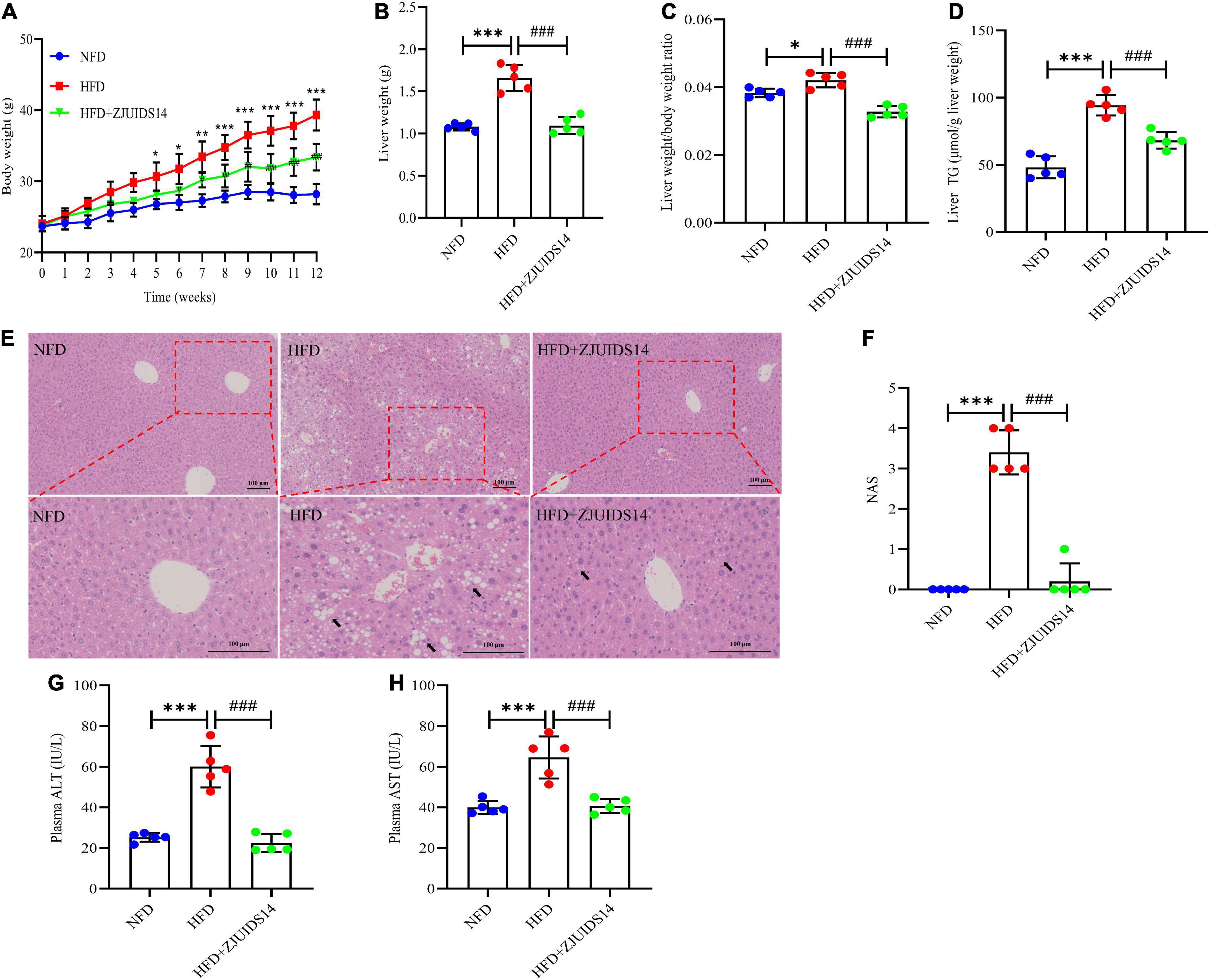 Lactobacillus plantarum ZJUIDS14 alleviates non-alcoholic fatty liver disease in mice in association with modulation in the gut microbiota